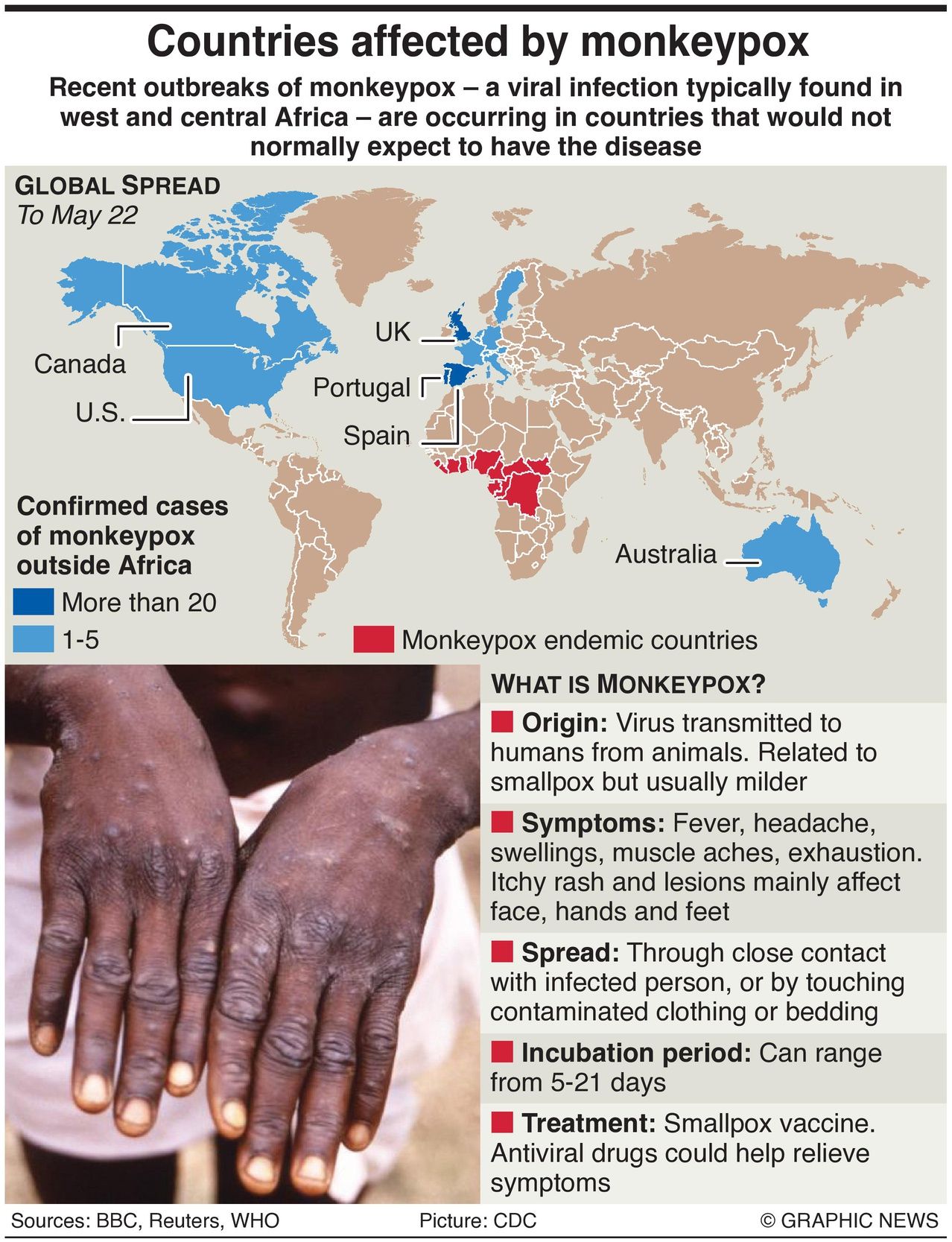 Which countries are currently affected by Monkey Pox - Infographic provided by graphic news